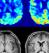 Medical Image Management, Core Lab, Clinical Trials | Medical Metrics 