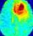 Clinical Trials, Medical Image Management | Medical Metrics 