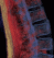 Clinical Trials, Medical Image Management | Medical Metrics 