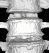 Medical Imaging, Core Lab, Clinical Trials | Medical Metrics 
