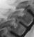 Medical Image Management, Core Lab, Clinical Trials | Medical Metrics 