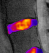 Medical Image Management, Core Lab, Clinical Trials | Medical Metrics 