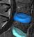 Medical Imaging, Core Lab, Clinical Trials | Medical Metrics 