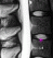 Medical Imaging, Core Lab, Clinical Trials | Medical Metrics 