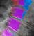 Medical Imaging, Core Lab, Clinical Trials | Medical Metrics 