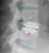 Medical Imaging, Core Lab, Clinical Trials | Medical Metrics 