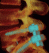 Medical Image Management, Core Lab, Clinical Trials | Medical Metrics 